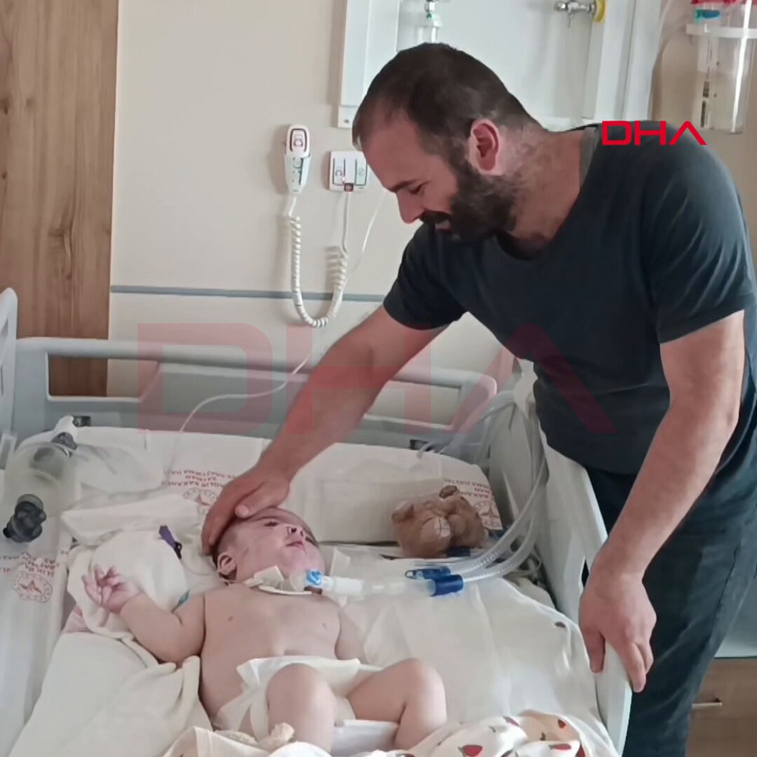 2 Yaşındaki Ayaz, 25 Ayda 16 Ameliyatla Yaşam Mücadelesi Veriyor