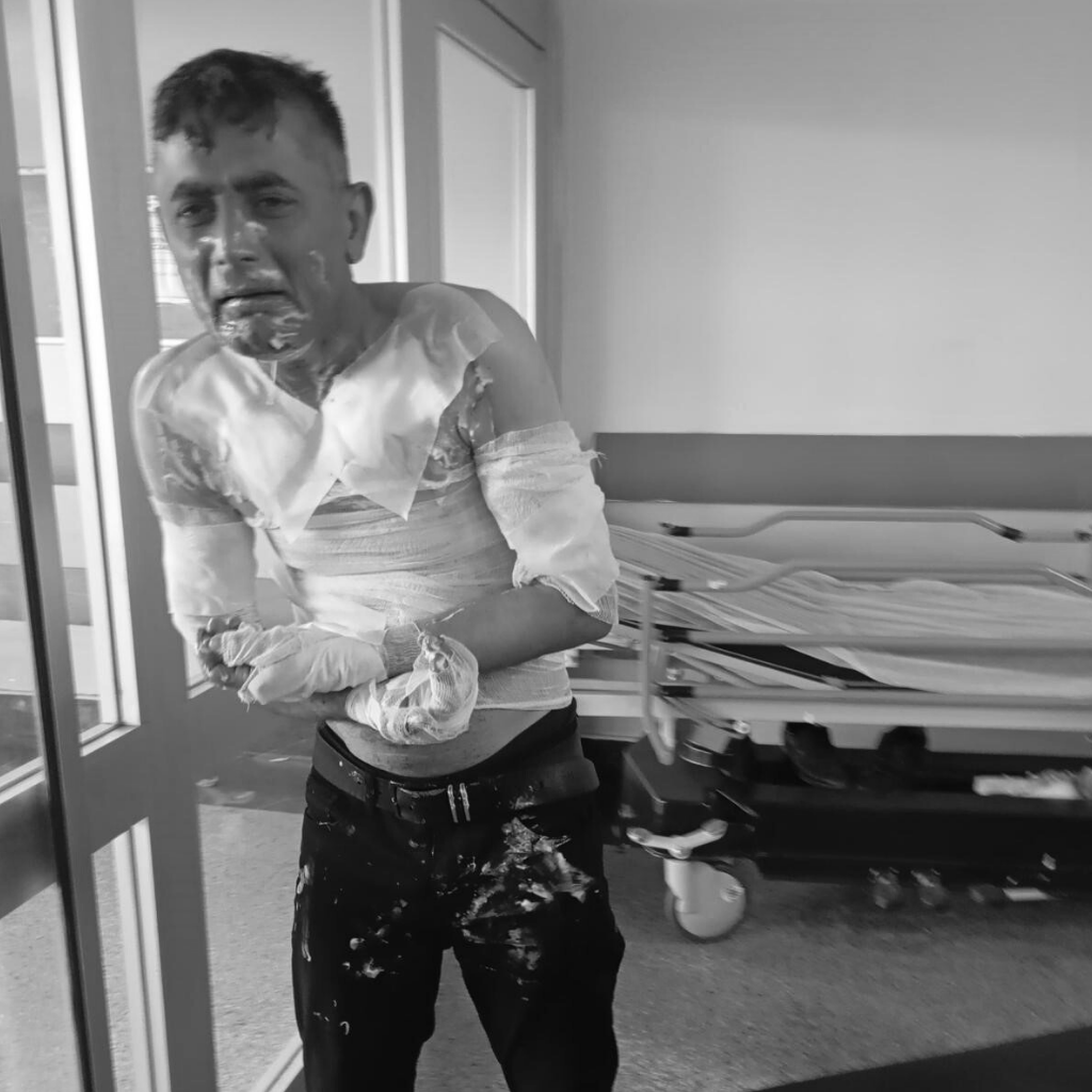 İstanbul'da Korkunç Olay: Engelli Vatandaş Benzin Dökülerek Yakıldı